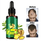 7 Days Hair Growth serum with Derma Roller With 540 Micro Needle Skin Therapy 0.50mm Natural Hair Treatment Effective Fast Growth Hair Care